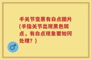 手关节变黑有白点图片(手指关节出现黑色斑点，有白点现象要如何处理？)