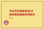 手关节处褶皱很深(手部皮肤起褶痕如何解决？)