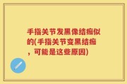 手指关节发黑像结痂似的(手指关节变黑结痂，可能是这些原因)