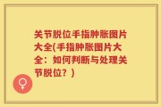 关节脱位手指肿胀图片大全(手指肿胀图片大全：如何判断与处理关节脱位？)