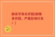 脚关节骨头开裂(脚踝骨开裂，严重影响行走！)