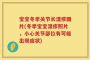 宝宝冬季关节长湿疹图片(冬季宝宝湿疹照片，小心关节部位有可能出现症状)