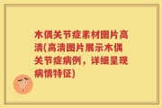 木偶关节症素材图片高清(高清图片展示木偶关节症病例，详细呈现病情特征)