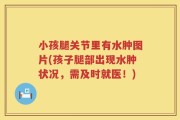小孩腿关节里有水肿图片(孩子腿部出现水肿状况，需及时就医！)