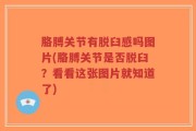 胳膊关节有脱臼感吗图片(胳膊关节是否脱臼？看看这张图片就知道了)