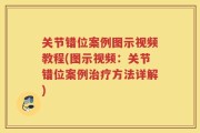 关节错位案例图示视频教程(图示视频：关节错位案例治疗方法详解)