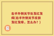 右手外侧关节处发红发痒(右手外侧关节皮肤发红发痒，怎么办？)