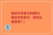 踝关节骨牵引的图片(踝关节骨牵引：如何正确使用？)