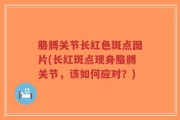 胳膊关节长红色斑点图片(长红斑点现身胳膊关节，该如何应对？)