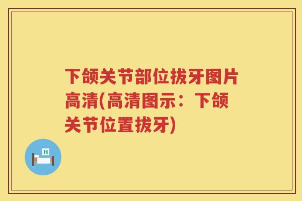 下颌关节部位拔牙图片高清(高清图示：下颌关节位置拔牙)