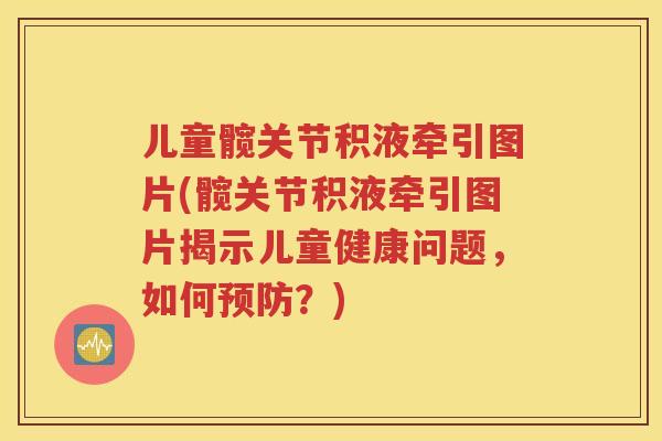 儿童髋关节积液牵引图片(髋关节积液牵引图片揭示儿童健康问题，如何？)