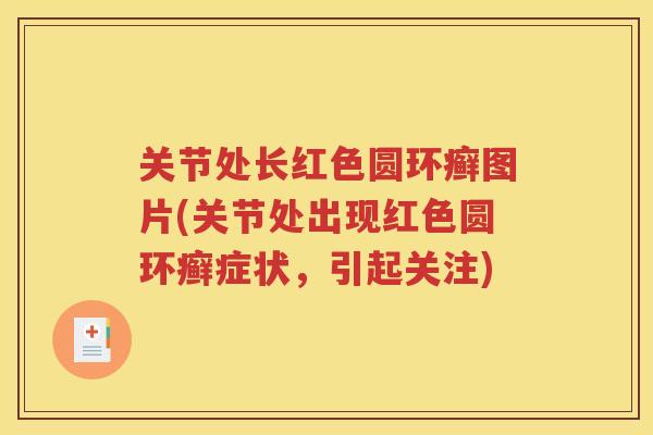 关节处长红色圆环癣图片(关节处出现红色圆环癣症状，引起关注)