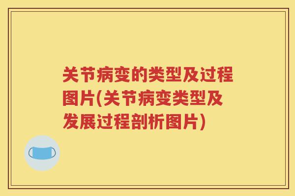 关节变的类型及过程图片(关节变类型及发展过程剖析图片)