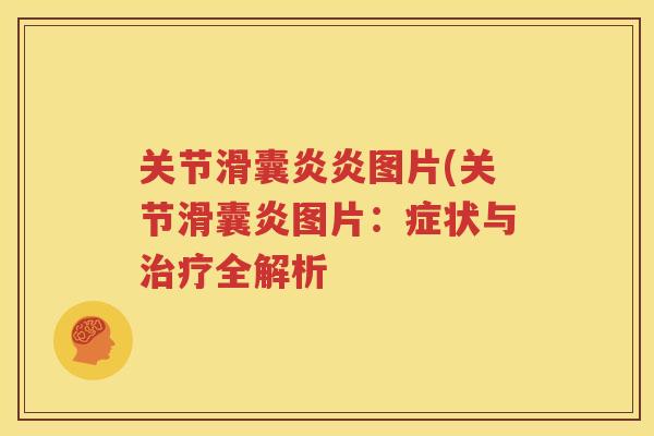 图片(关节图片：症状与全解析