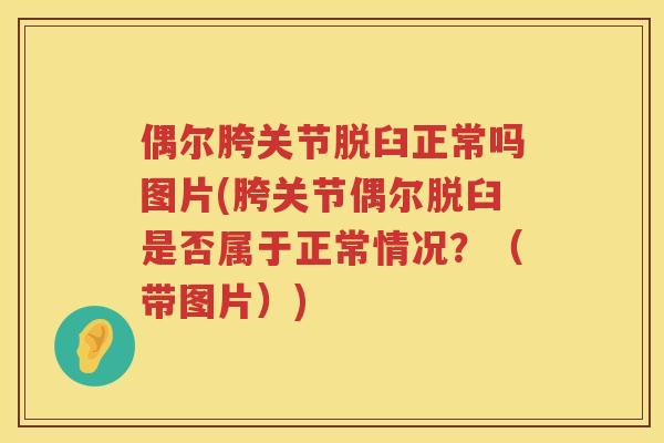 偶尔胯关节脱臼正常吗图片(胯关节偶尔脱臼是否属于正常情况？（带图片）)