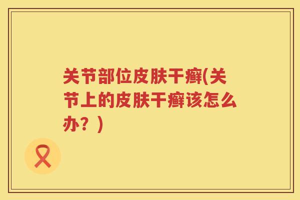 关节部位干癣(关节上的干癣该怎么办？)