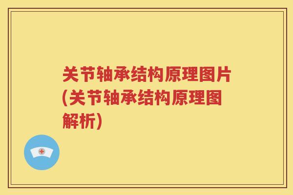 关节轴承结构原理图片(关节轴承结构原理图解析)