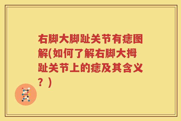 右脚大脚趾关节有痣图解(如何了解右脚大拇趾关节上的痣及其含义？)