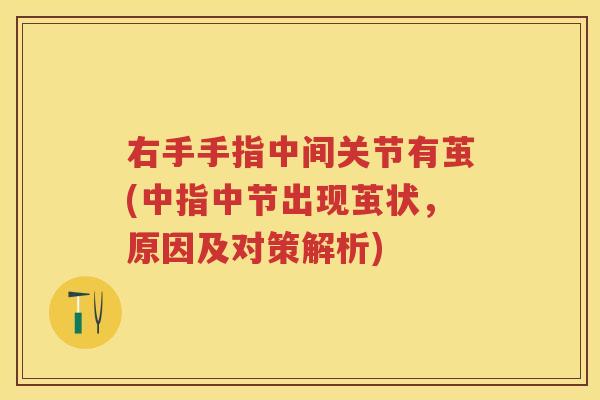 右手手指中间关节有茧(中指中节出现茧状,原因及对策解析) 右手手指中间关节有茧(中指中节出现茧状,原因及对策解析)