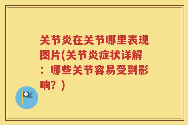 在关节哪里表现图片(关节状详解：哪些关节容易受到影响？)