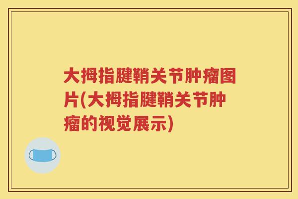 大拇指腱鞘关节图片(大拇指腱鞘关节的视觉展示)