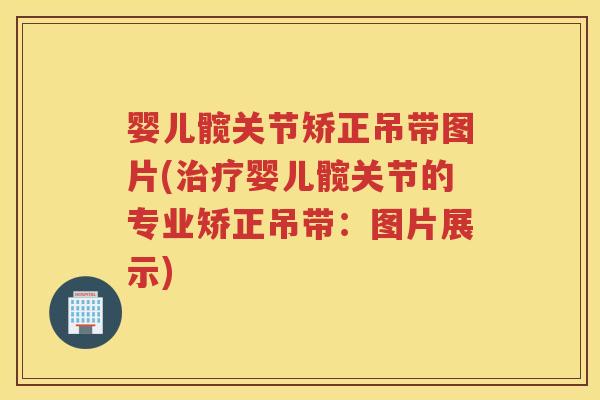 婴儿髋关节矫正吊带图片(婴儿髋关节的专业矫正吊带:图片展示) 婴儿髋关节矫正吊带图片(婴儿髋关节的专业矫正吊带:图片展示)