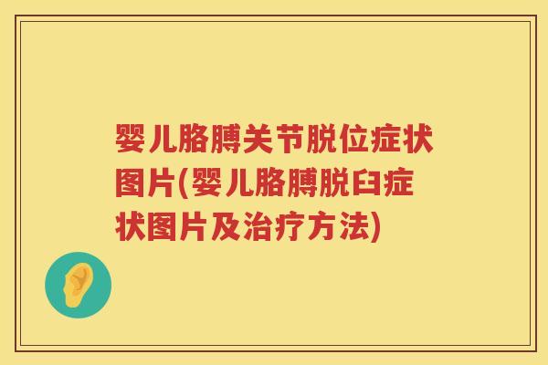 婴儿胳膊关节脱位症状图片(婴儿胳膊脱臼症状图片及方法) 婴儿胳膊关节脱位症状图片(婴儿胳膊脱臼症状图片及方法)