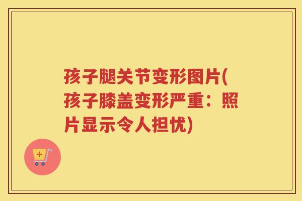 孩子腿关节变形图片(孩子膝盖变形严重:照片显示令人担忧) 孩子腿关节变形图片(孩子膝盖变形严重:照片显示令人担忧)