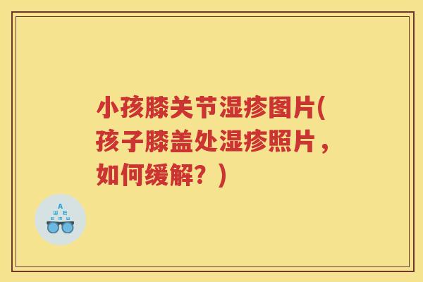小孩膝关节图片(孩子膝盖处照片,如何缓解?) 小孩膝关节图片(孩子膝盖处照片,如何缓解?)