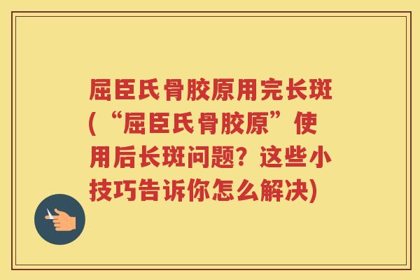 屈臣氏骨胶原用完长斑(“屈臣氏骨胶原”使用后长斑问题?这些小技巧告诉你怎么解决) 屈臣氏骨胶原用完长斑(“屈臣氏骨胶原”使用后长斑问题?这些小技巧告诉你怎么解决)