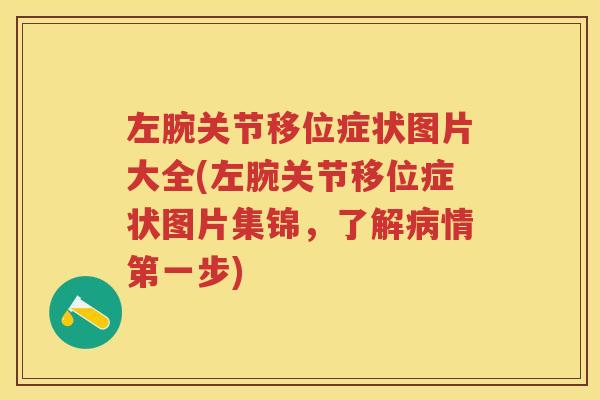 左腕关节移位症状图片大全(左腕关节移位症状图片集锦,了解情第一步) 左腕关节移位症状图片大全(左腕关节移位症状图片集锦,了解情第一步)