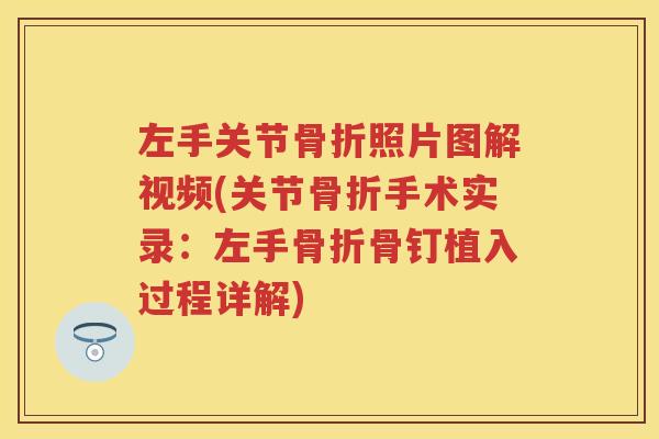 左手关节照片图解视频(关节手术实录:左手骨钉植入过程详解) 左手关节照片图解视频(关节手术实录:左手骨钉植入过程详解)