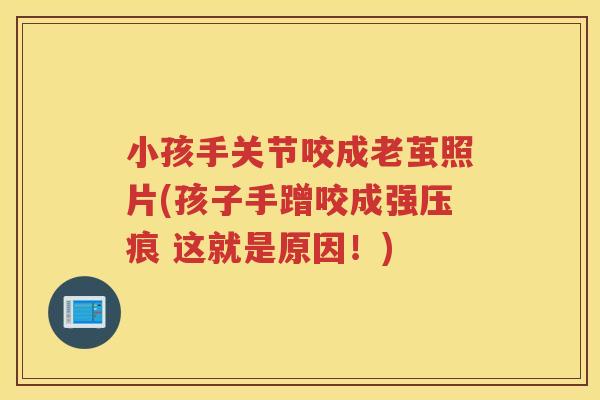 小孩手关节咬成老茧照片(孩子手蹭咬成强压痕 这就是原因!) 小孩手关节咬成老茧照片(孩子手蹭咬成强压痕 这就是原因!)