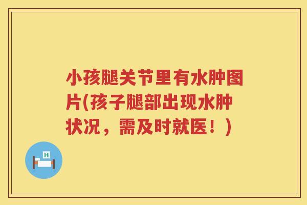 小孩腿关节里有水肿图片(孩子腿部出现水肿状况,需及时就医!) 小孩腿关节里有水肿图片(孩子腿部出现水肿状况,需及时就医!)