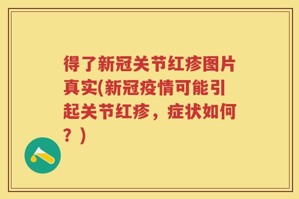 得了新冠关节红疹图片真实(新冠疫情可能引起关节红疹,症状如何?) 得了新冠关节红疹图片真实(新冠疫情可能引起关节红疹,症状如何?)