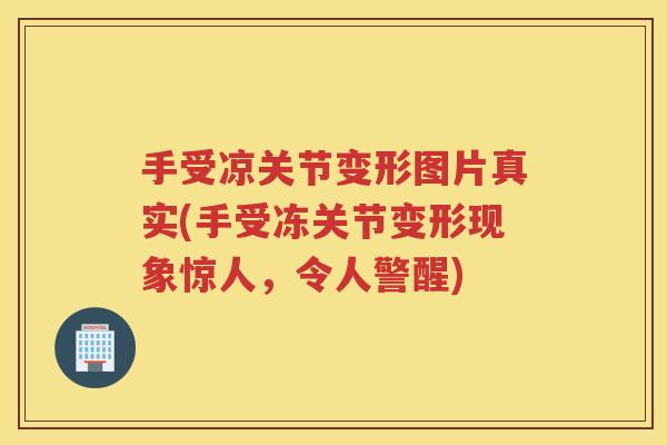 手受凉关节变形图片真实(手受冻关节变形现象惊人,令人警醒) 手受凉关节变形图片真实(手受冻关节变形现象惊人,令人警醒)