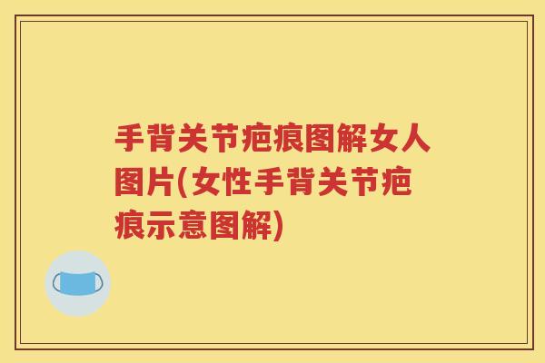 手背关节疤痕图解女人图片(女性手背关节疤痕示意图解) 手背关节疤痕图解女人图片(女性手背关节疤痕示意图解)