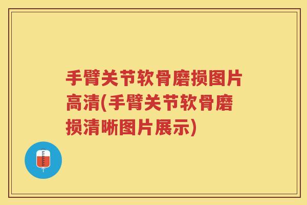 手臂关节软骨磨损图片高清(手臂关节软骨磨损清晰图片展示) 手臂关节软骨磨损图片高清(手臂关节软骨磨损清晰图片展示)