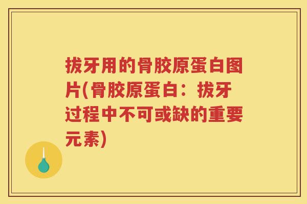 拔牙用的骨胶原蛋白图片(骨胶原蛋白:拔牙过程中不可或缺的重要元素) 拔牙用的骨胶原蛋白图片(骨胶原蛋白:拔牙过程中不可或缺的重要元素)