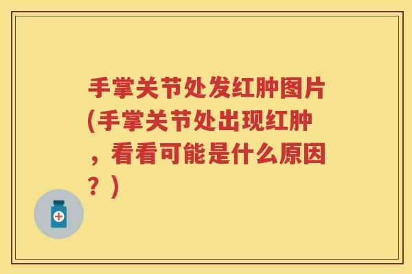 手掌关节处发红肿图片(手掌关节处出现红肿,看看可能是什么原因?) 手掌关节处发红肿图片(手掌关节处出现红肿,看看可能是什么原因?)