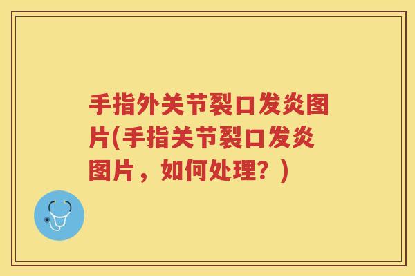 手指外关节裂口发炎图片(手指关节裂口发炎图片,如何处理?) 手指外关节裂口发炎图片(手指关节裂口发炎图片,如何处理?)