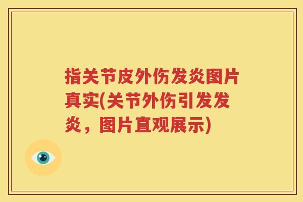 指关节皮外伤发炎图片真实(关节外伤引发发炎,图片直观展示) 指关节皮外伤发炎图片真实(关节外伤引发发炎,图片直观展示)