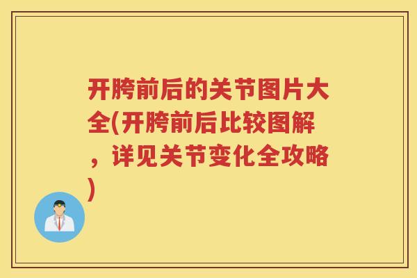 开胯前后的关节图片大全(开胯前后比较图解,详见关节变化全攻略) 开胯前后的关节图片大全(开胯前后比较图解,详见关节变化全攻略)