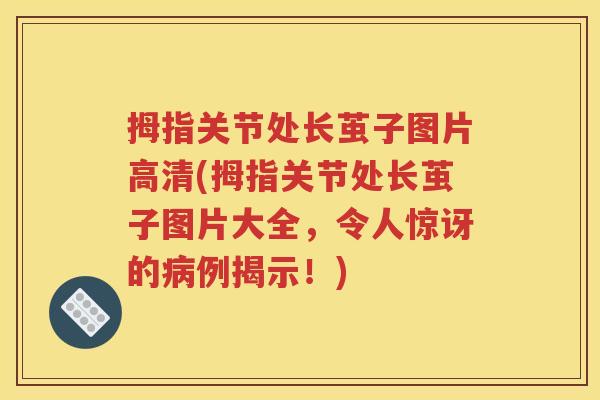 拇指关节处长茧子图片高清(拇指关节处长茧子图片大全，令人惊讶的例揭示！)