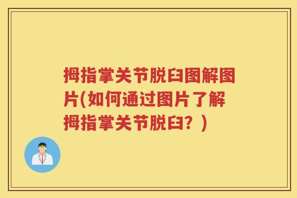 拇指掌关节脱臼图解图片(如何通过图片了解拇指掌关节脱臼?) 拇指掌关节脱臼图解图片(如何通过图片了解拇指掌关节脱臼?)