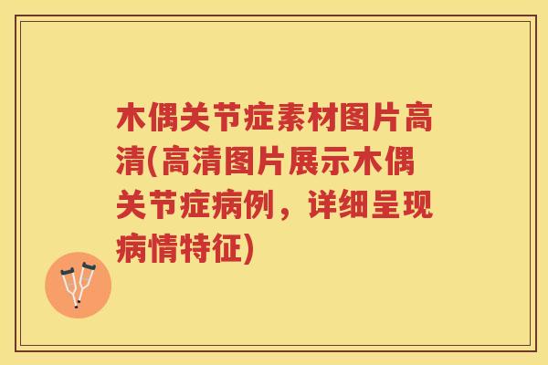 木偶关节症素材图片高清(高清图片展示木偶关节症例,详细呈现情特征) 木偶关节症素材图片高清(高清图片展示木偶关节症例,详细呈现情特征)