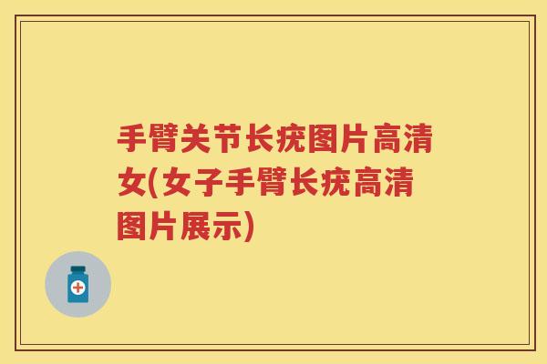 手臂关节长疣图片高清女(女子手臂长疣高清图片展示)
