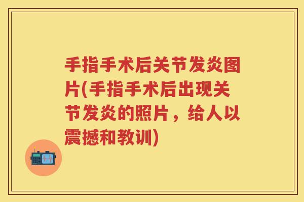 手指手术后关节发炎图片(手指手术后出现关节发炎的照片,给人以震撼和教训) 手指手术后关节发炎图片(手指手术后出现关节发炎的照片,给人以震撼和教训)