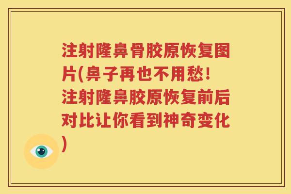 注射隆鼻骨胶原恢复图片(鼻子再也不用愁！注射隆鼻胶原恢复前后对比让你看到神奇变化)
