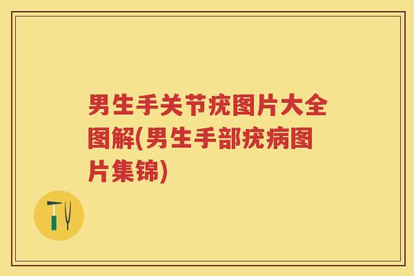 男生手关节疣图片大全图解(男生手部疣图片集锦) 男生手关节疣图片大全图解(男生手部疣图片集锦)